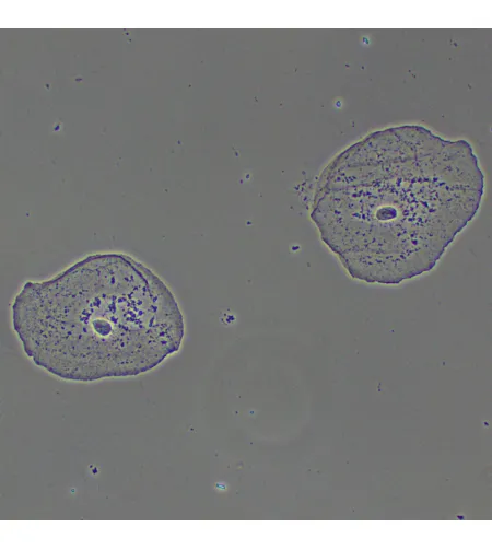 MAGUS PH2 fazinio kontrasto prietaisas