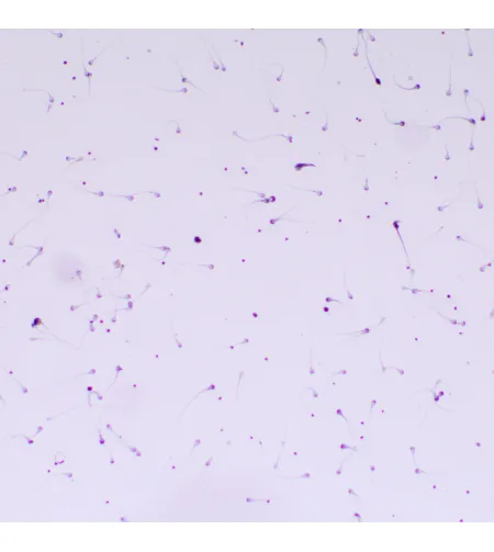 MAGUS Bio D260T LCD biologinis skaitmeninis mikroskopas