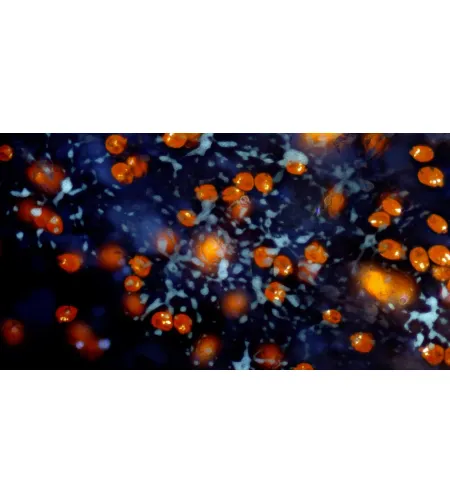 BRESSER MikroCamII 9MP 4K 1'' mikroskopa kamera