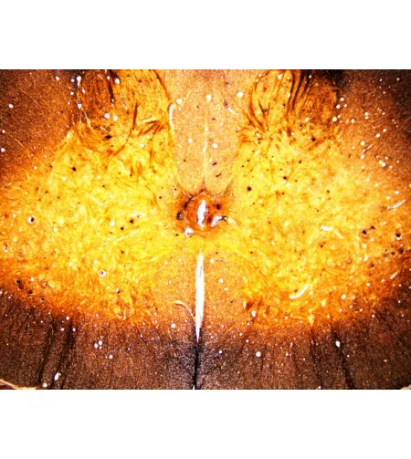 BRESSER Gatavie slaidi 25 gab. Kaste