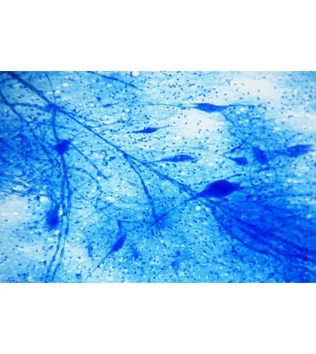 BRESSER Gatavie slaidi 25 gab. Kaste